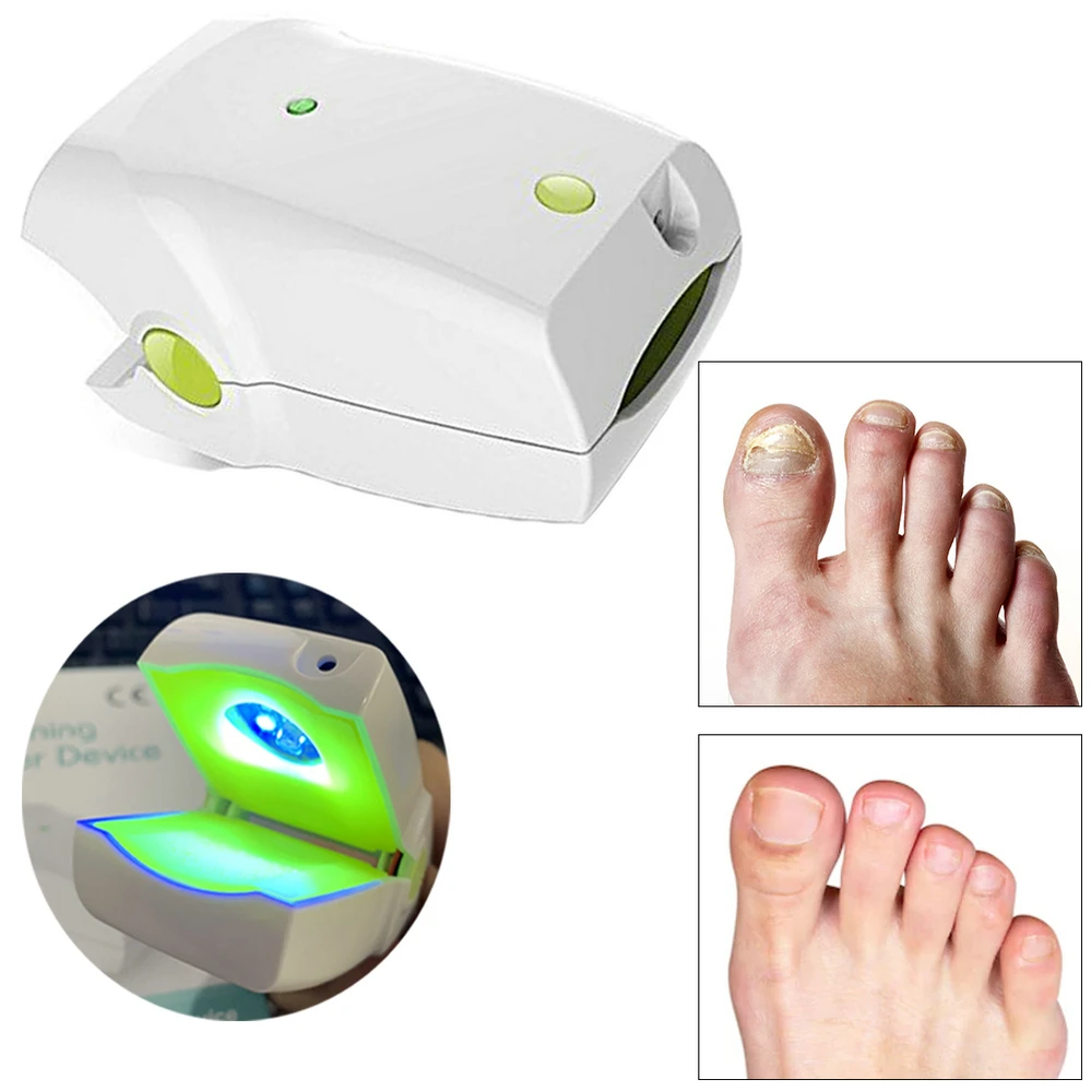 Nail Mushroom Cleaning Laser Device Toenail Fungus Laser Treatment Nail Infection Onychomycosis Cure Fungal Infections