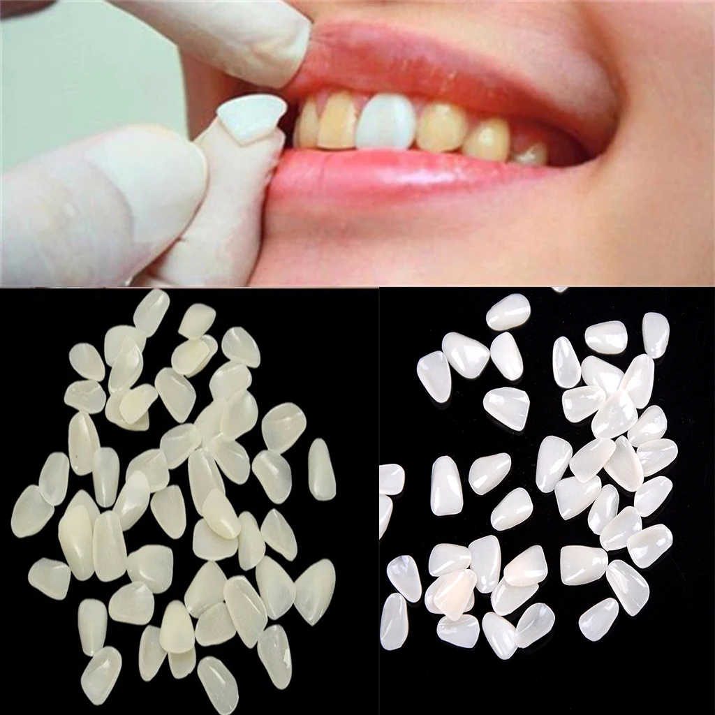 Teeth Veneers Resin Temporary Crown Ultra Thin Dental Oral Care Dentist False Tooth Whitening Repair Sets Dentistry Materials
