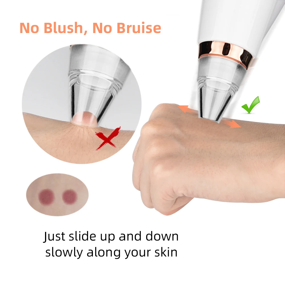 Blackhead Remover Removal Skin Care Facial Electric Acne Cleaner Vacuum Tool Black Spots Pore Face Deep Cleaning Machine