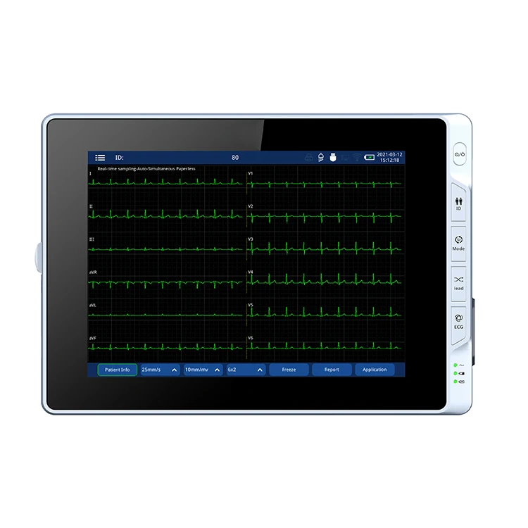 ecg 6 channel portable ecg machine ecg monitor 9.7 Inch HD screen electrocardiogram