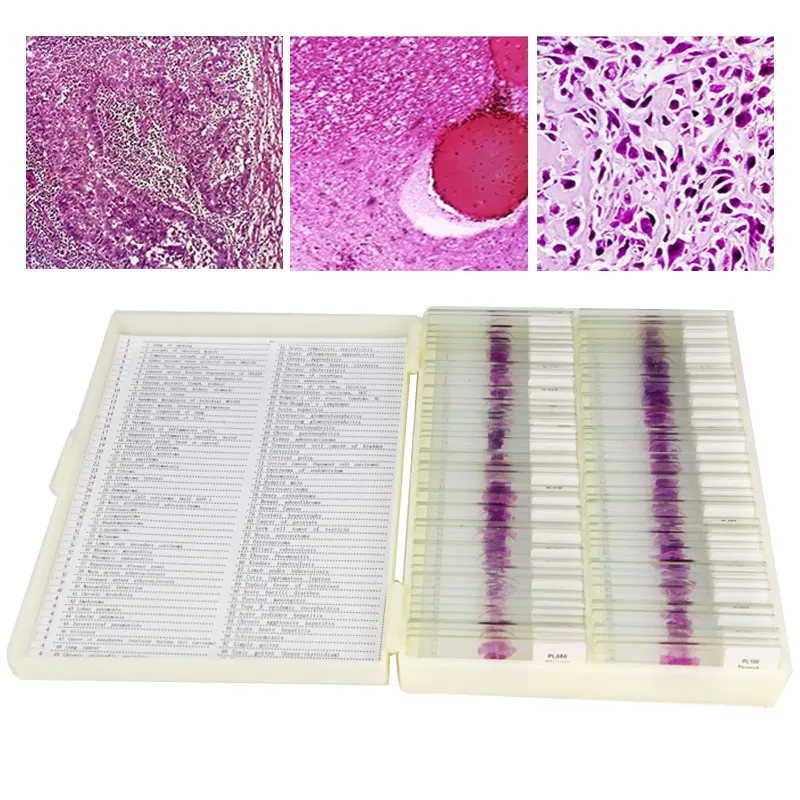 100PCS Medical Pathological Sections of Human Body HE Staining Typical Prepared Tissue Specimen Slides Microscope Glass Slice