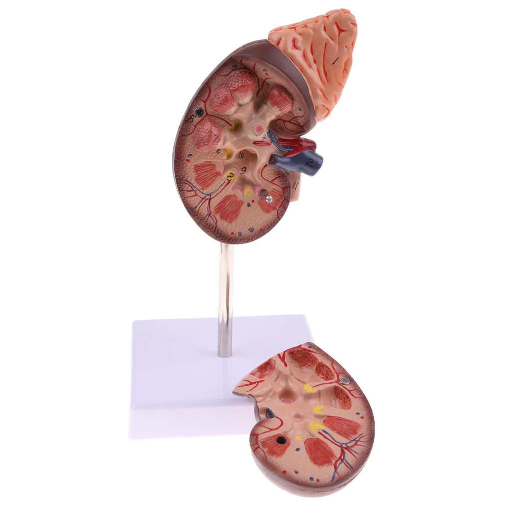 1:1 Lifesize Kidney Model Removable 2 Parts Kidney with Adrenal Gland Anatomical Model (with Base) for School Lab Tool Kits