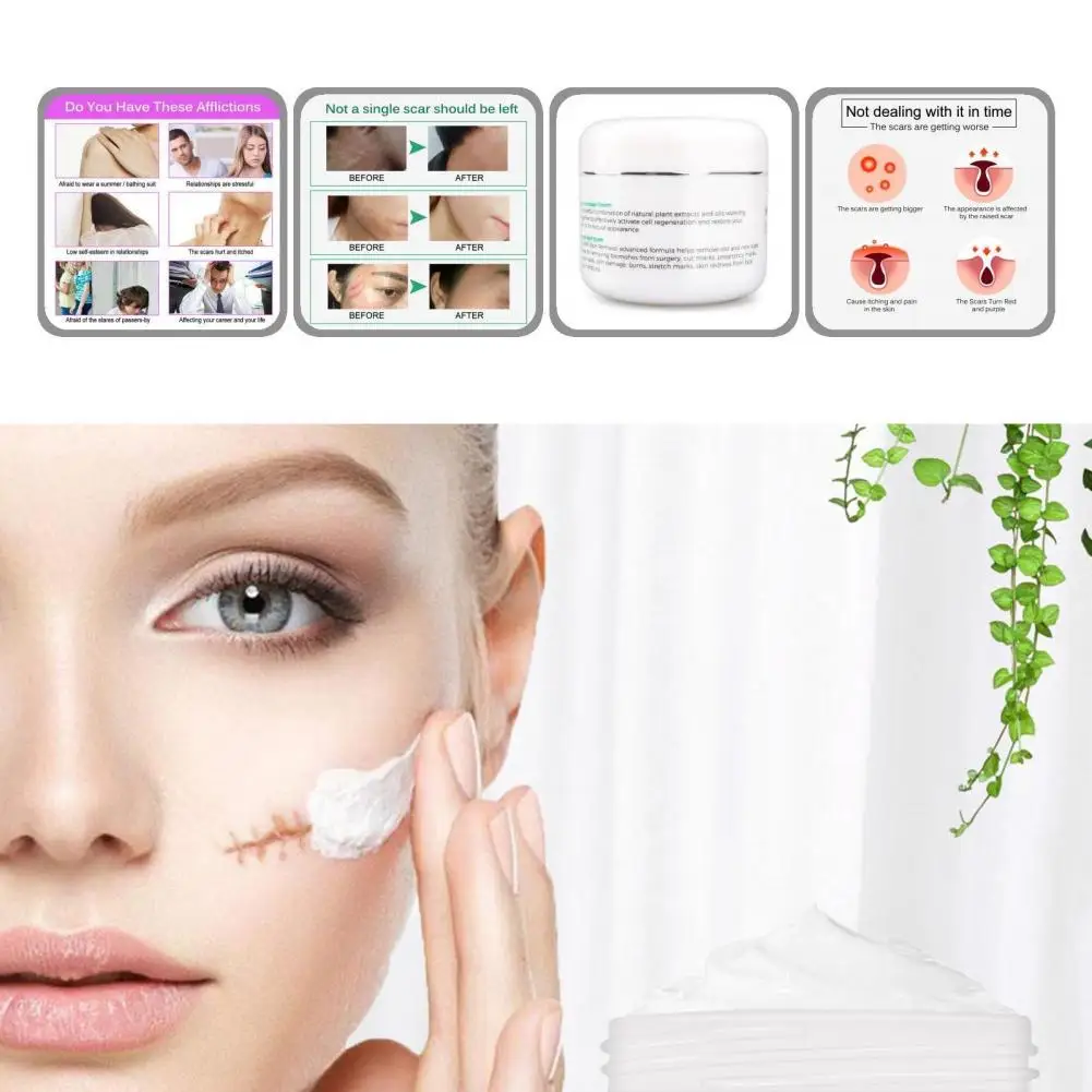 

Repairing Scars Anti-aging Product Scar Skin Stretch Mark Treatment for Body Part