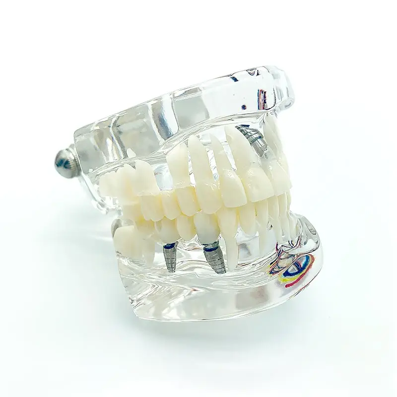 Teeth Model Dentistry Products Pathologies Repair Model with Nerve