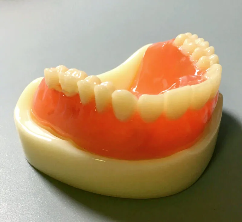 Dental pełna proteza Model Overdenture magnetyczne mocowanie górne badanie żuchwy