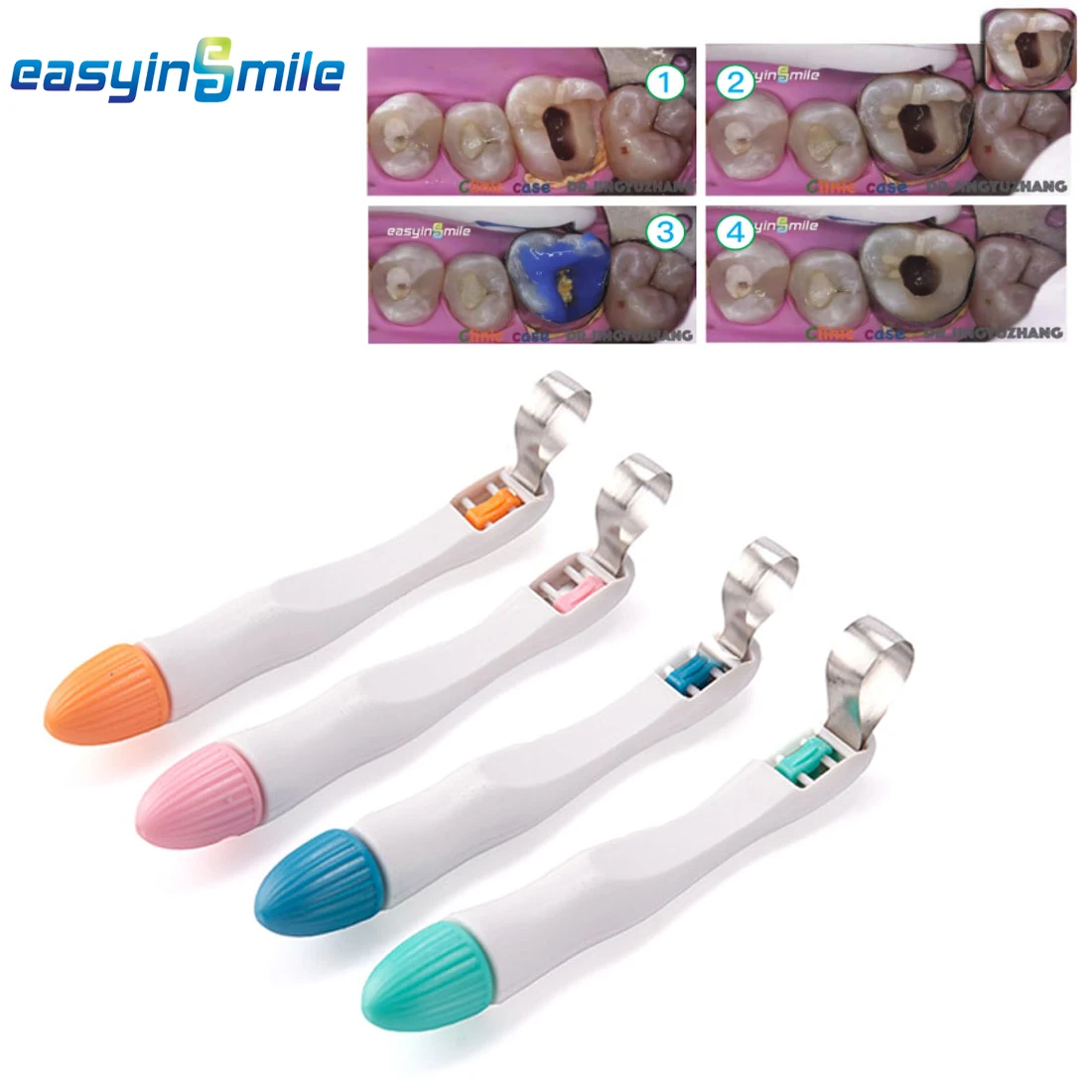 50pcs EASYINSMILE Dental Pro Matrix Bands Sectional Contoured Matrice Ring System Standard and Curved Dentales Matrix Pre Formed