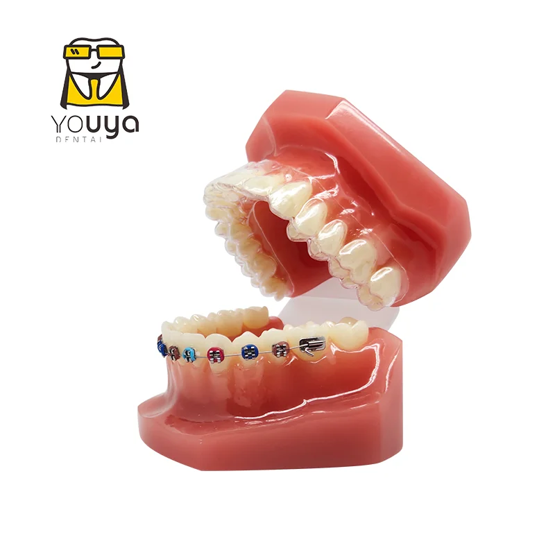 Dental Model With Braces Dentistry Materials Orthodontic Models Gum Tooth Teeth Model For Studying Teaching Patient Education