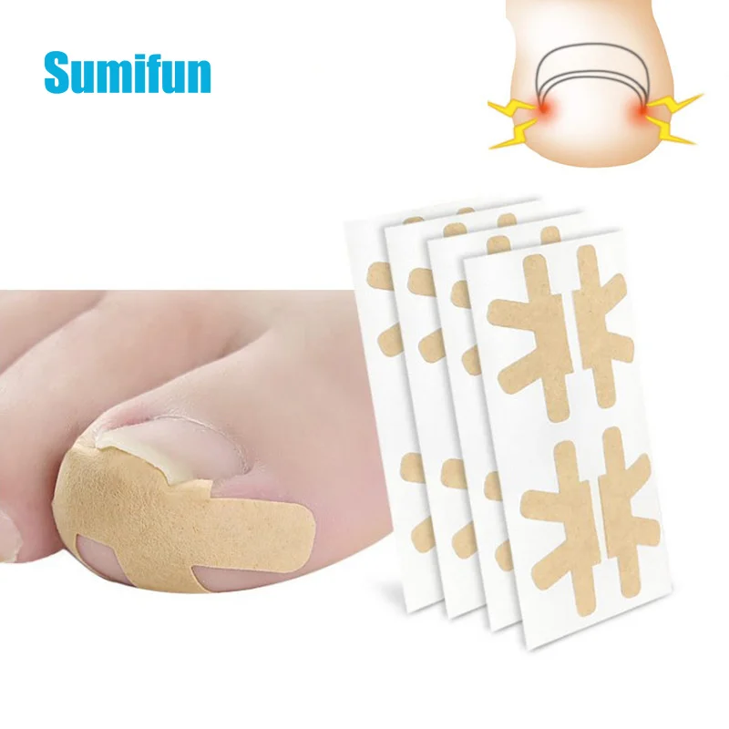 

4pcs Professional Embedded Toe Nail Corrector Sticker Ingrown Toenail Care Pedicure Thumb Curl Correction Pastes Nail Care