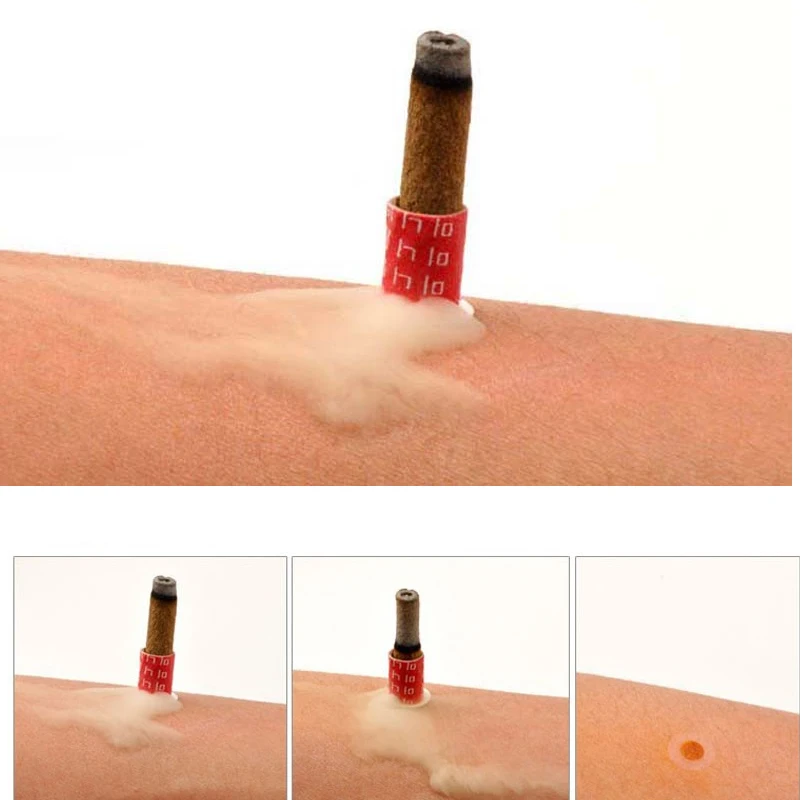 high quality Smokeless self-stick Moxa tube acupuncture massage moxibustion tube 180pcs moxa sticks