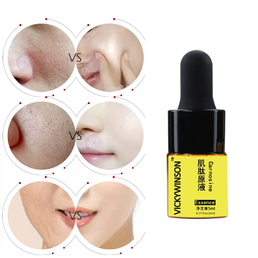 L-carnosin essenz 5ml Bleaching Serum Hyaluronsäure Gesicht Creme Anti-Aging Feine Linien Serum Entfernung Akne Poren Haut pflege