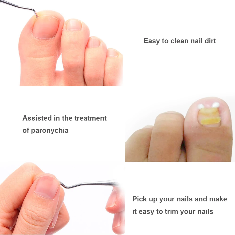 1PC Useful Ingrown Toe Nail Lifter Double Head Paronychia Pedicure Tool Foot Nail Dirt Cleaning Stainless Steel Manicure Tool