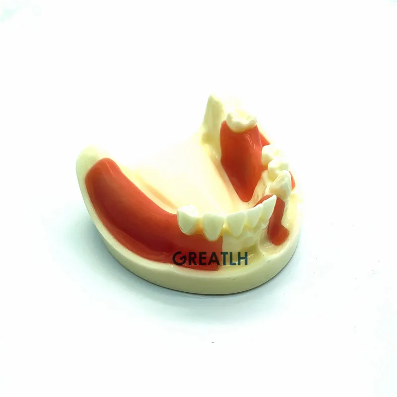 Dental Implant Practice model Lower Jaw model with missing teeth for cutting and suturing Typodont Teeth Model with Gingiva