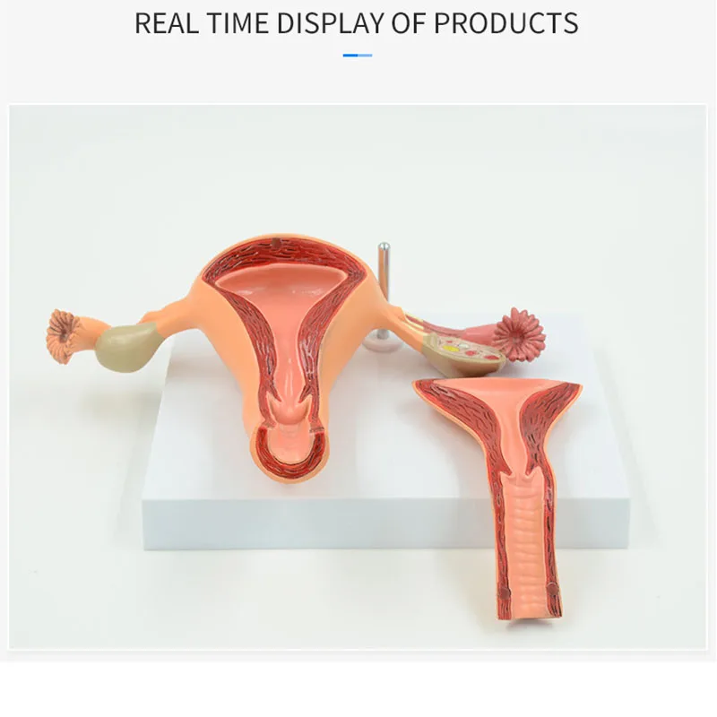 Medical Science Normal/Pathological Uterus Ovary Anatomical Model Anatomy Cross Section Medical teaching supplies