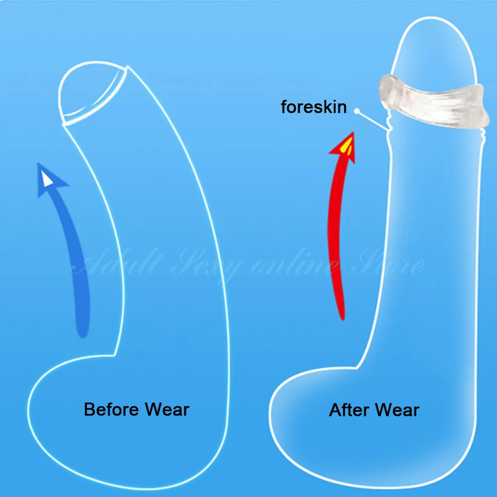 2PCS Reusable Foreskin Corrector for Men Sex Toys Cock Ring Delay Ejaculation Glans Training Penis Stretcher Sexshop