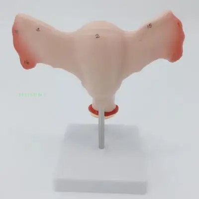 Female reproductive uterus model, vaginal ovary model, healthy teaching mould pathological change scientific teaching AIDS