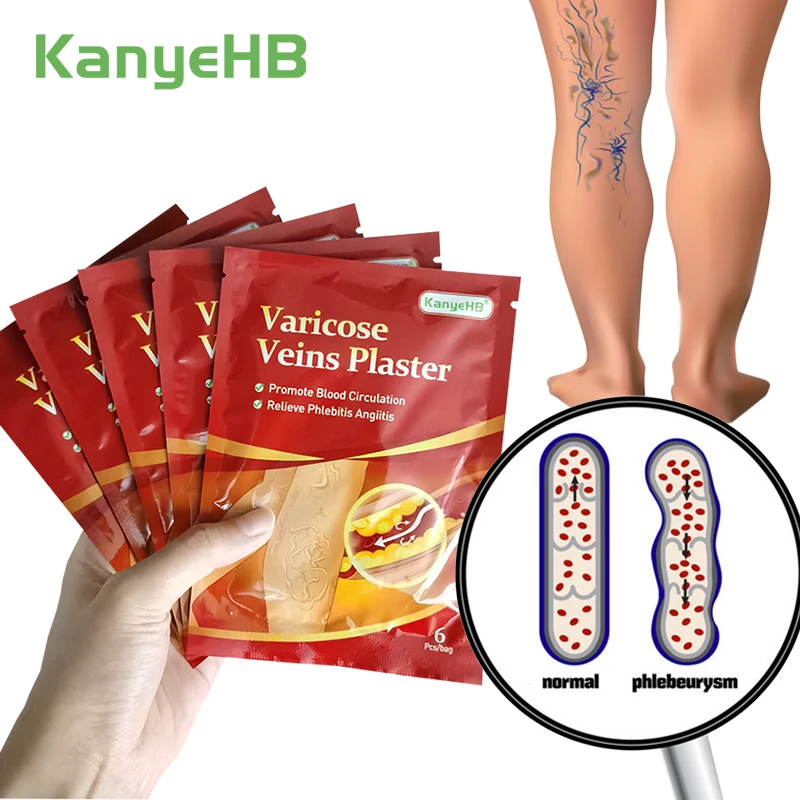 

24pcs/4bags Varicose Veins Treatment Plaster Remove Varicosity Medical Patch Varication Treatment Sticker Healthcare Paste A595