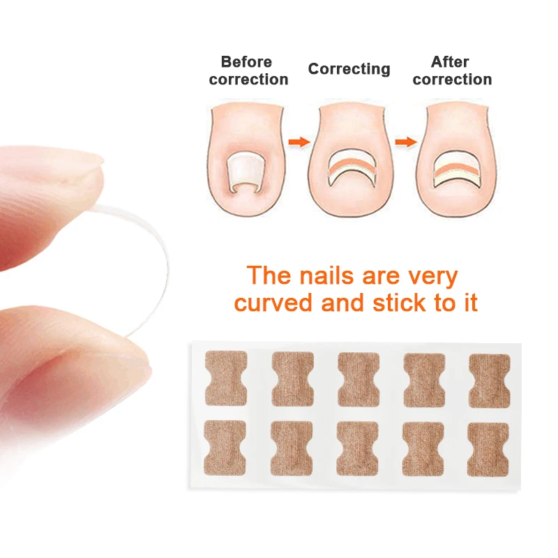 40pcs Toenail Correction Patch Orthodontic Toe Thumb Sticker Finger Paronychia Treatment Pedicure Glue Free Ingrown Patch D3743