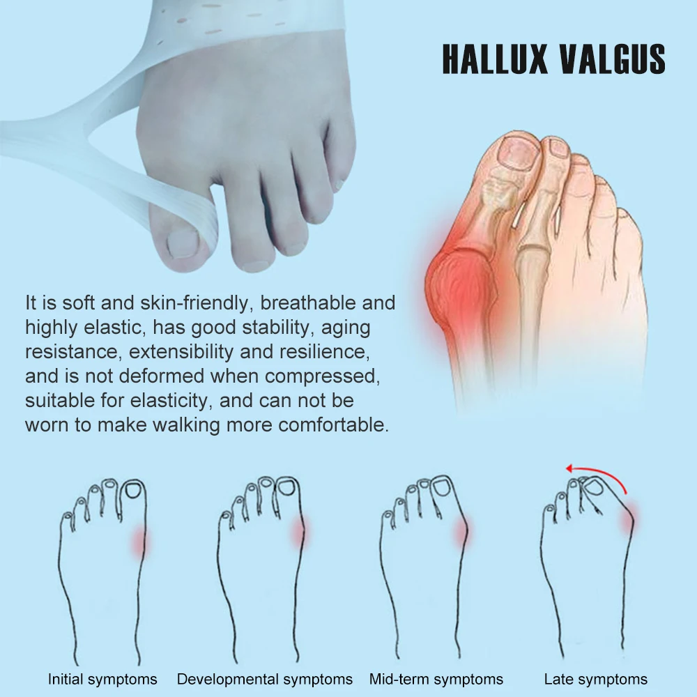 1 Pasang Bantuan Korektor Bunion Silikon, Pemisah Jempol Kaki Besar Pelurus Kaki untuk Hallux Valgus dan Jempol Kaki Besar Pereda Nyeri Sendi