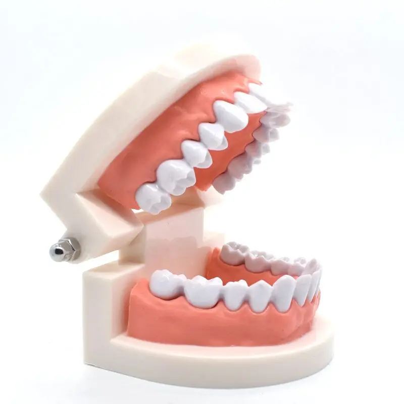 

Dental Teeth Model Caries Tooth Care Oral Education Study Teaching Dentist Equipment Oral Care Tool