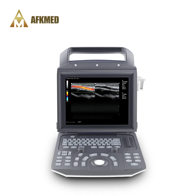 Op Verkoop Factory Aangepaste Draagbare Kleur Doppler Medische Echografie Instrumenten Ultrasound Machines