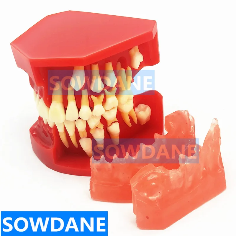 Dental Children Deciduous Teeth Model Replacement Model Permanent Teeth Alternate Display Removable Demonstration for Teaching