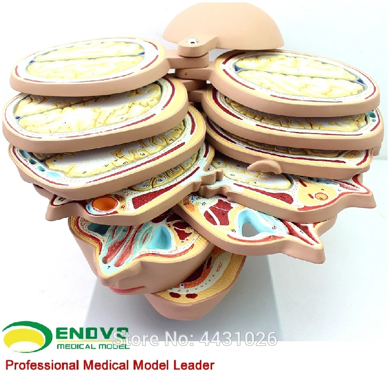 ENOVO Brain brain transection model in medical human brain CT MRI brain magnetic resonance imaging