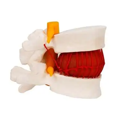 Human lumbar intervertebral disc demonstration model skeletal model Human lumbar spine spine joint model medical