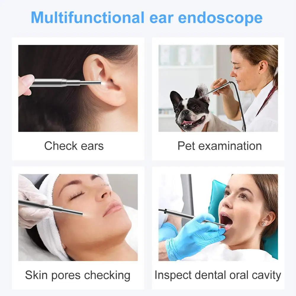 3.9mm 720P Ear Spoon Cleaning Tool 1.3MP Android Type C USB Medical Otoscope Inspection Camera Ear Nasal Earpick Endoscope