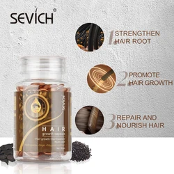 Sevich – capsules nourrissantes pour la croissance des cheveux au gingembre, 30 pièces/bouteille, traitement pour la perte de cheveux, Polygonum multiflorum, sérum pour aider à noircir