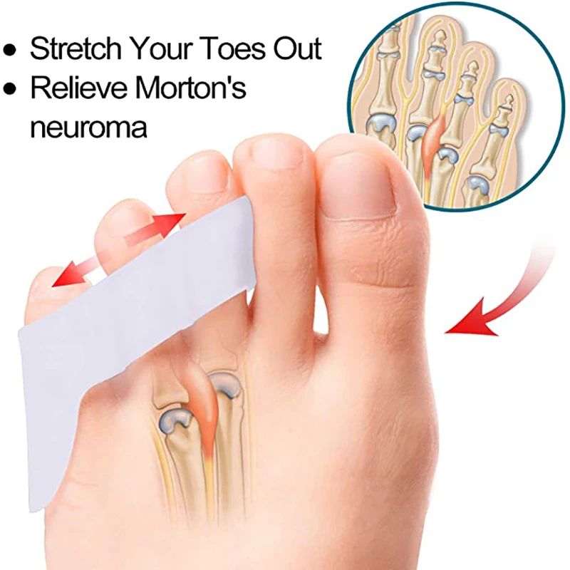 Bộ 2 Gel Silicone Ít Ngón Chân Chia Chồng Chéo Ngón Chân Máy Duỗi Bunion Vỉ Giảm Đau Ngón Chân Bảo Vệ Chăm Sóc Chân Dụng Cụ