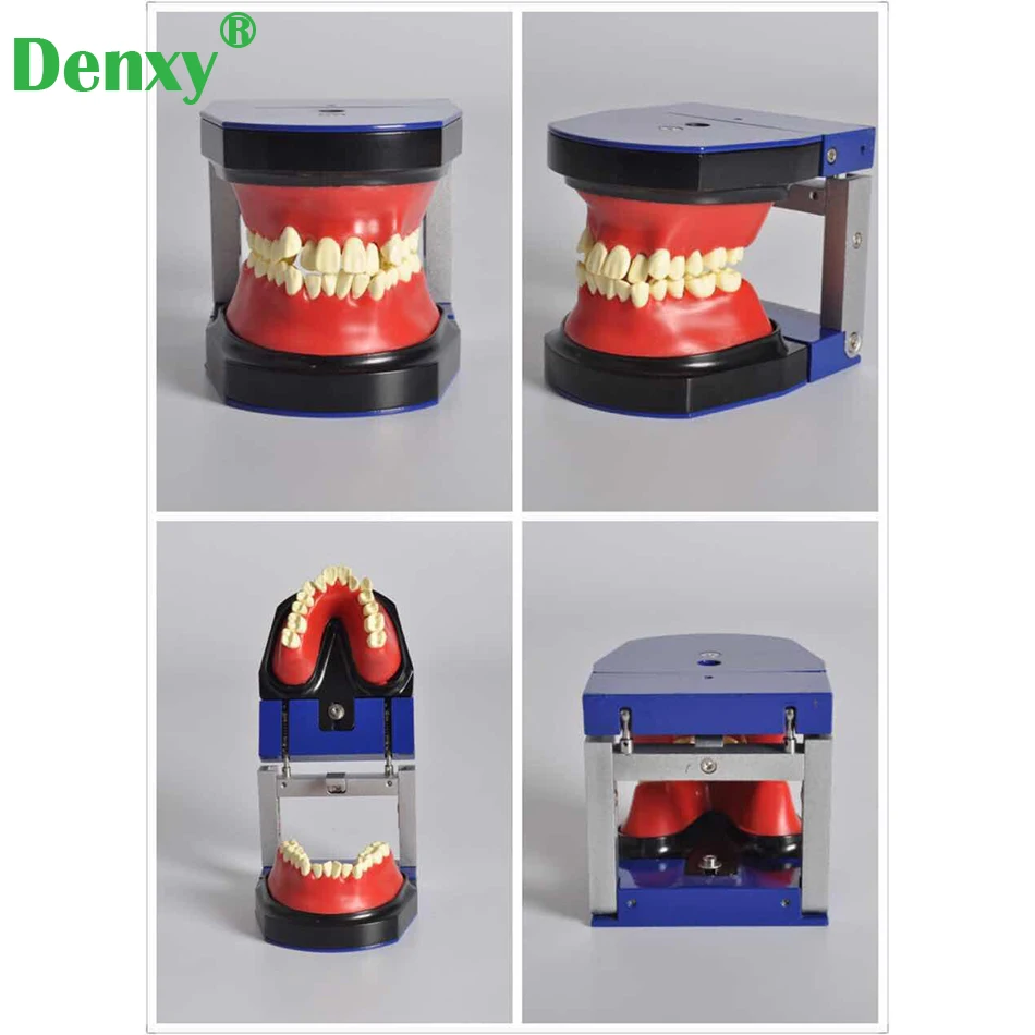 

Denxy Dental Orthodontic Treatment Model Typodont Study Teeth Model Metal Ceramic Bracket Arch Wire Buccal Tube Ligature Ties