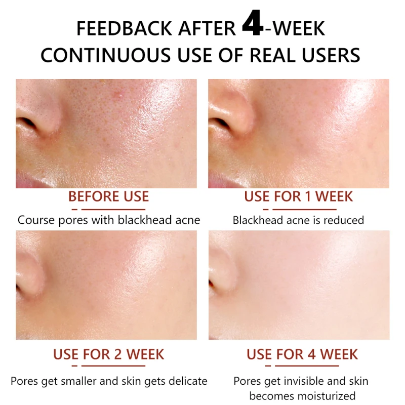 المسام تقلص مصل السائل تبييض ترطيب المسام الرعاية تخفيف جفاف النفط السيطرة مصل العناية بالبشرة TSLM1 #5
