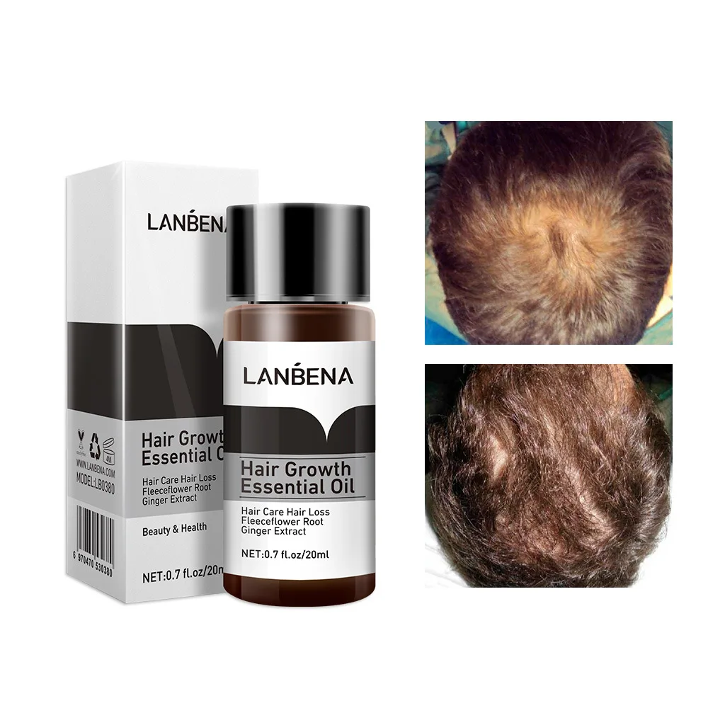 LANBENA Hair Growth Essence Products Hair Fast Powerful Essential Oil Liquid Treatment Preventing Hair Loss Hair Serum Care 20ml