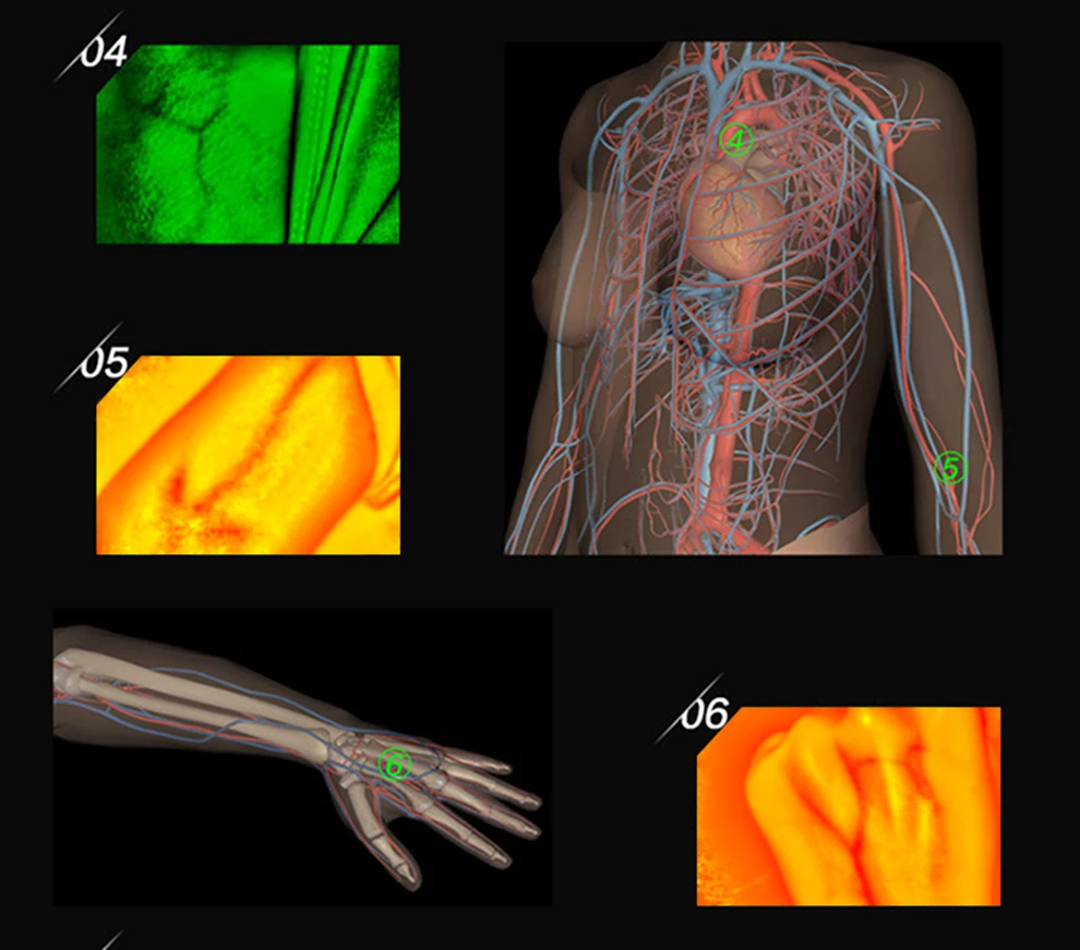 Erwachsene Kinder geeignet Vene Viewer Display Lichter Bildgebung finden Vene Medical Vene Finder Vene Viewer – Detail 8