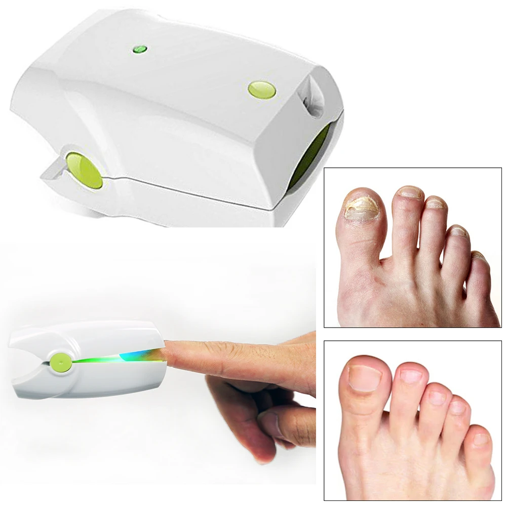 

Toenail Fungus Nail Cleaning Laser device for onychomycosis 905nm laser 470nm blue light therapy nail fungus treatment