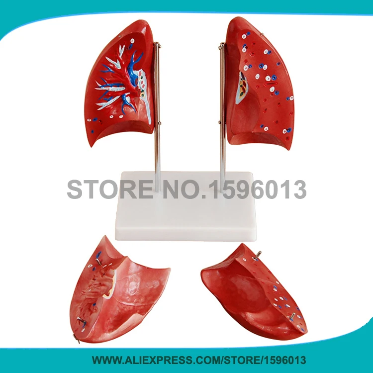 

4 parts Detachable Lung model Human Lung AnatomyModel