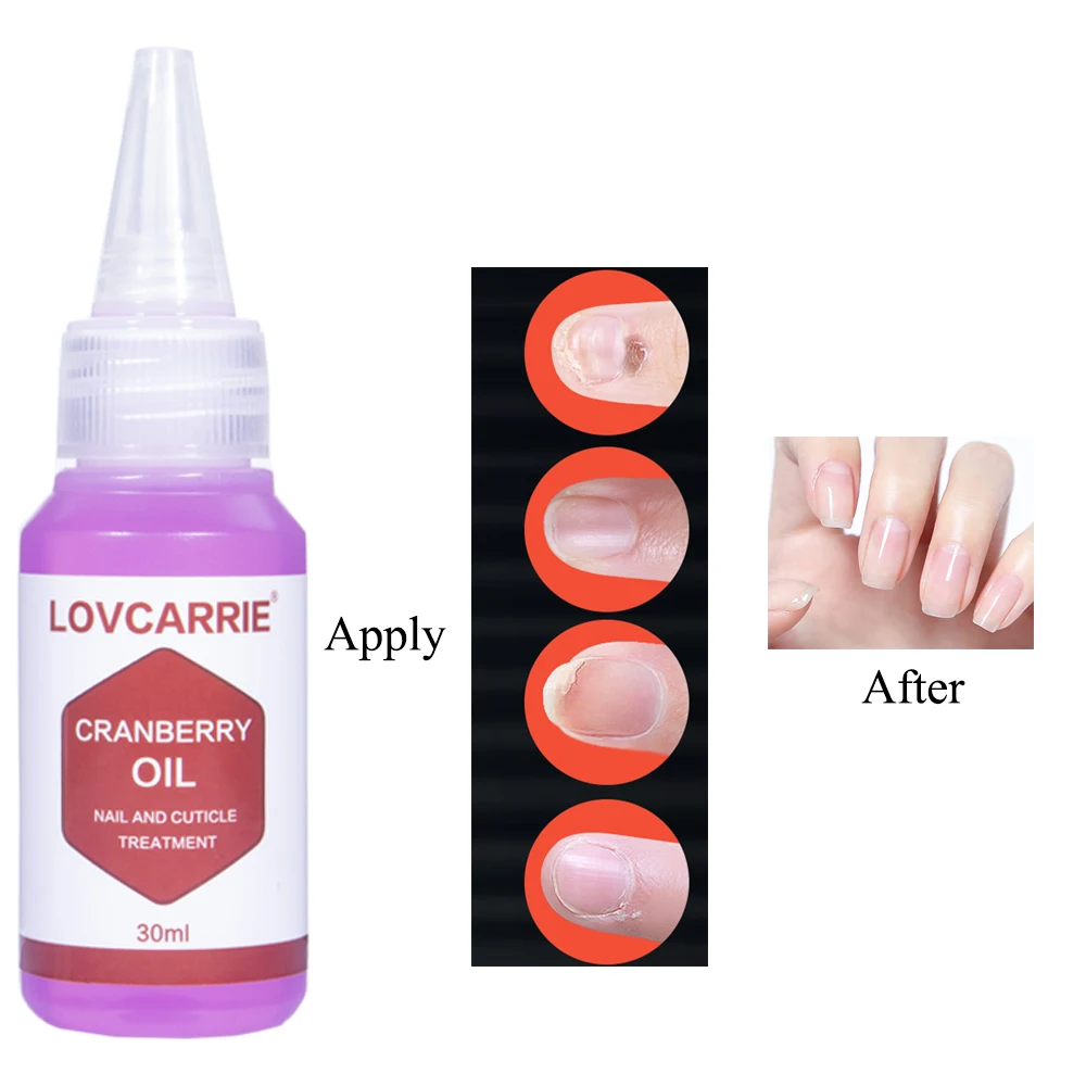 LOVCARRIE 30ML Cuticle Oil Professional Nails Revit Liquid Nutrition Nail Art Treatment Tools for Thin Nails Repair 2021 NEW