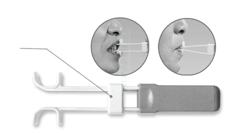 Motor gear adsorbent, tongue muscle rehabilitation hemiplegia, oral extension language barrier