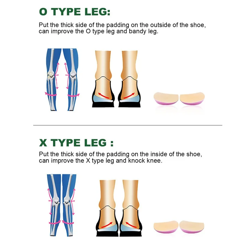 1 par de palmilhas ortopédicas, inserções de sapato, medial e calcanhar lateral, almofadas de silicone, corretivas, tipo o/x, perna para mulheres/homens
