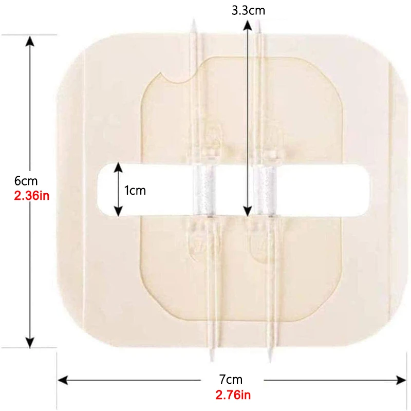 Vendaje adhesivo con cremallera para heridas, tiras de laceración de emergencia sin sutura para Kit de supervivencia, kit de primeros auxilios, cuidado de Trauma, 2 piezas