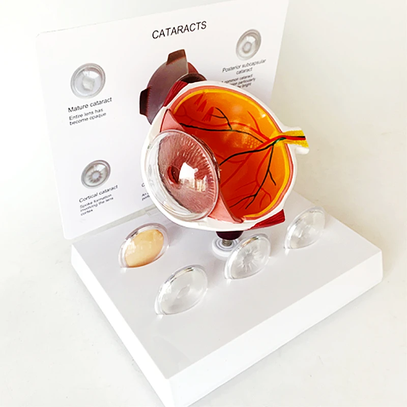 4X Human Pvc Eye Cataract Anatomy Medical Teaching Model