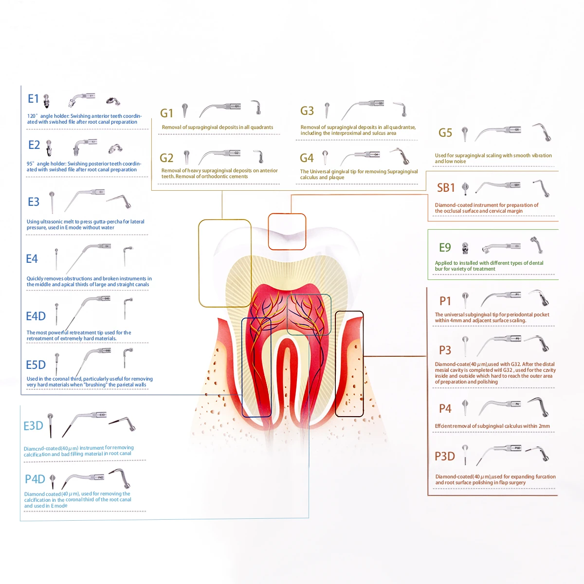 AZDENT 치과용 초음파 스케일러 팁, 스케일링 치주요법, Endo, Perio 스케일링 팁, G P E, EMS 및 WOODPEKER에 적합