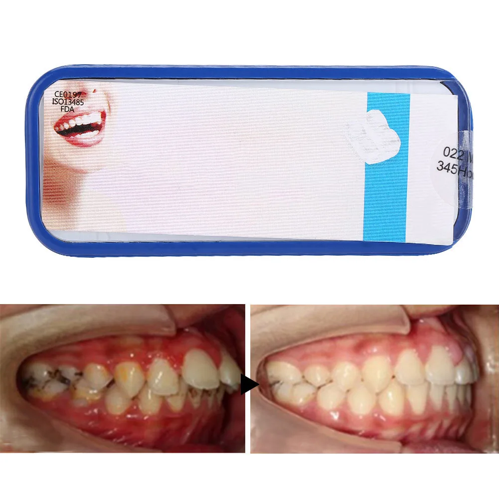 Soportes de cerámica para ortodoncia Dental, Material metálico de 20 piezas, ranura Roth 022 345 con gancho, accesorios de tratamiento Oral estables