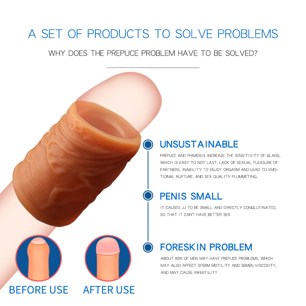 Foreskin Correction Penis Sleeve For Men Delay Ejaculation Screw Shape Penis Ring Cock Ring Sex Toys For Men Adult Sex Products