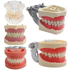 Dental Model Teeth Model Dental Teaching Model Standard Model with 32 Screw-in Teeths Demonstration Soft Hard Gum 28 24 Teeth