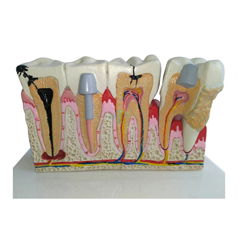 1pcs Dental Tooth Teeth Anatomical Model  Dental Anatomy Teeth Model Oversized Anatomy