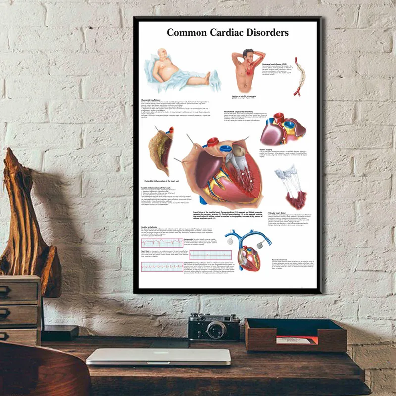 Anatomical Chart Human Body Anatomy Medical Art Painting Silk Canvas Poster Wall Home Decor картины на стену картины