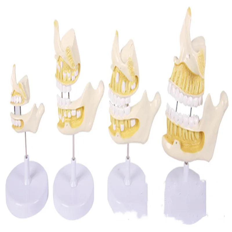 

Medical model human dental anatomy model dental development sequence model