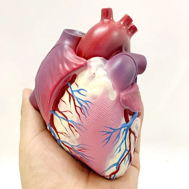 Human Atherosclerosis Thrombosis Heart Disease Model Anatomy Heart Structure Internal Pathology Visceral Heart Valve