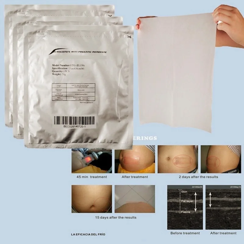 

Anti Freezing Membranes For Fat Freezing 100Pcs Antifreeze Membrane 0.07G Bag 24*40.5Cm Cooling Therapy Pads